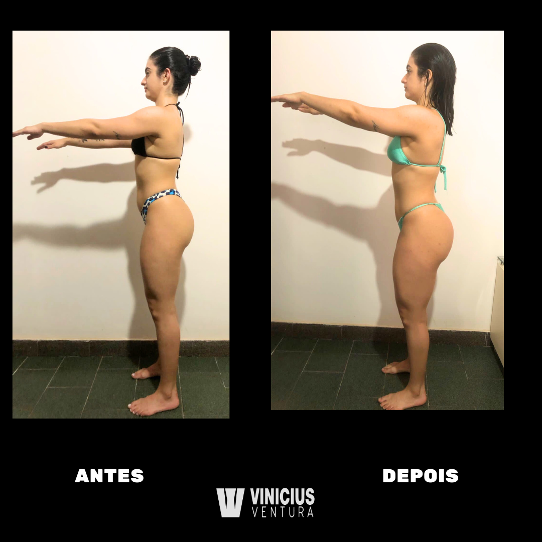 antesdepois2