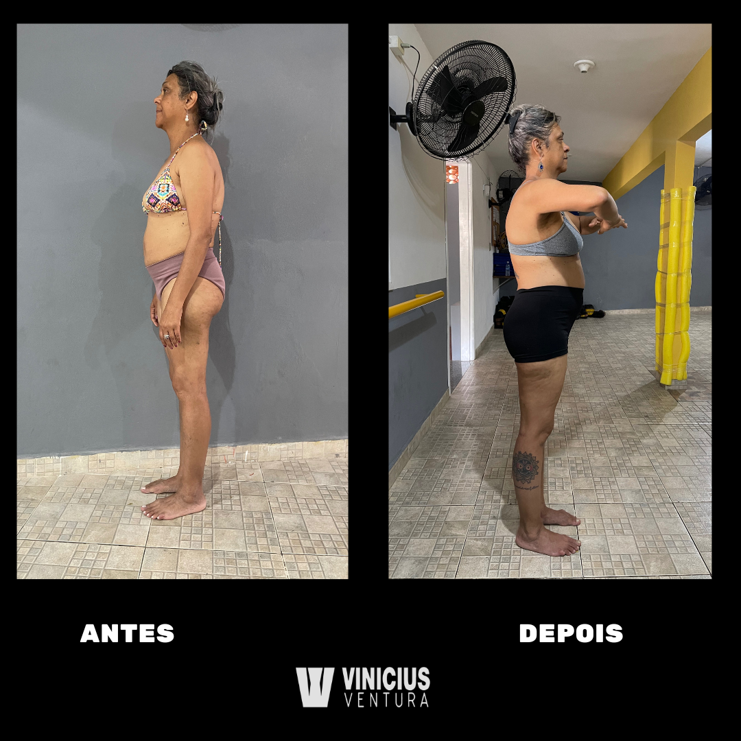 antesdepois3